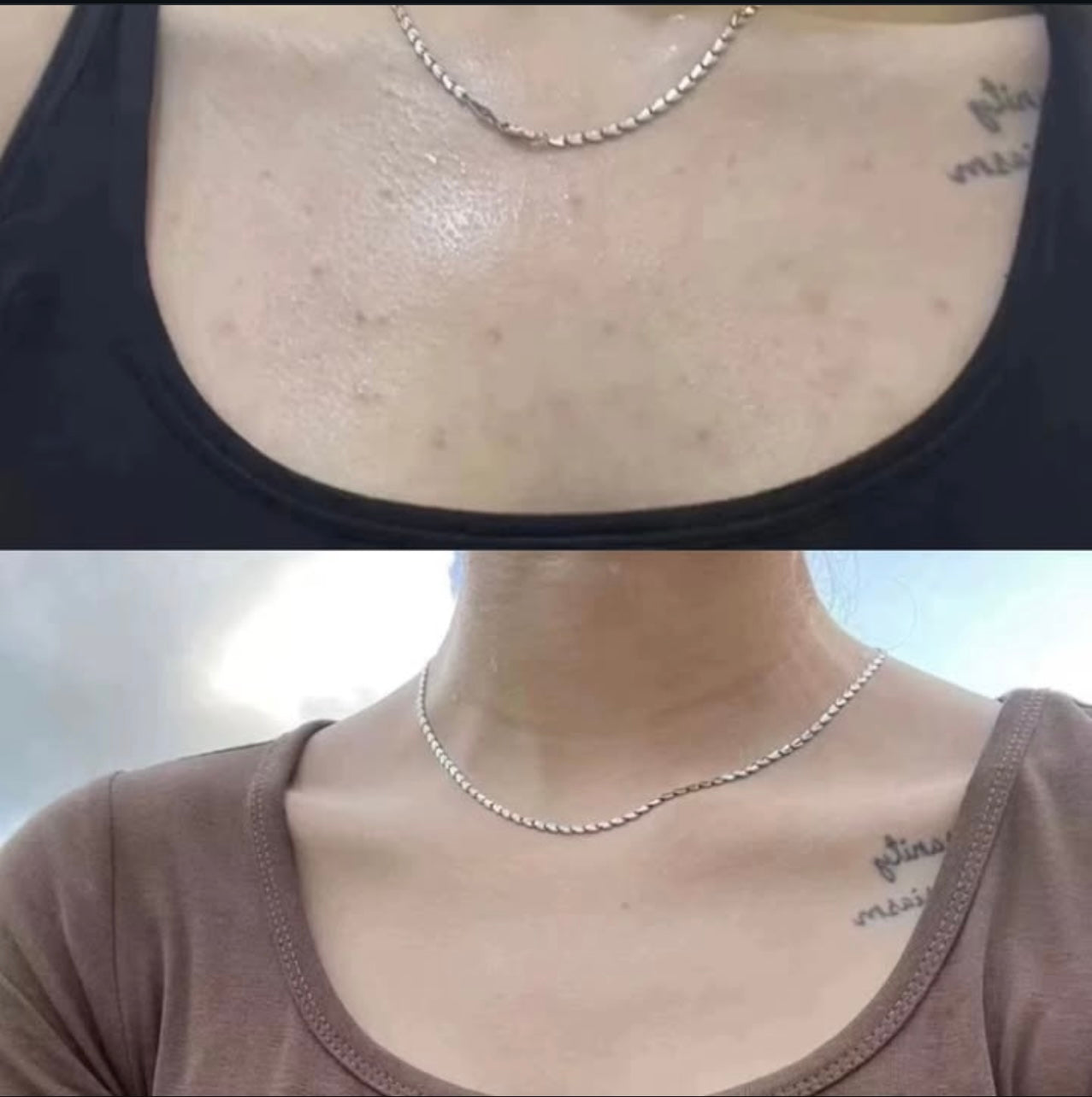 DERMA:B AC Control Body Mist بخاخ علاجي للجسم