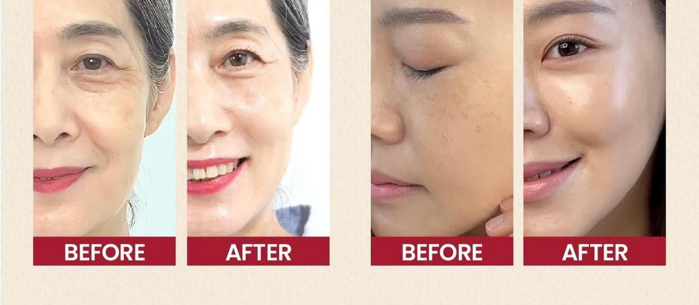 K-SECRET Seoul 1988 Serum: Retinal Liposome 1% + Black Ginseng ريتنال كي سيكرت