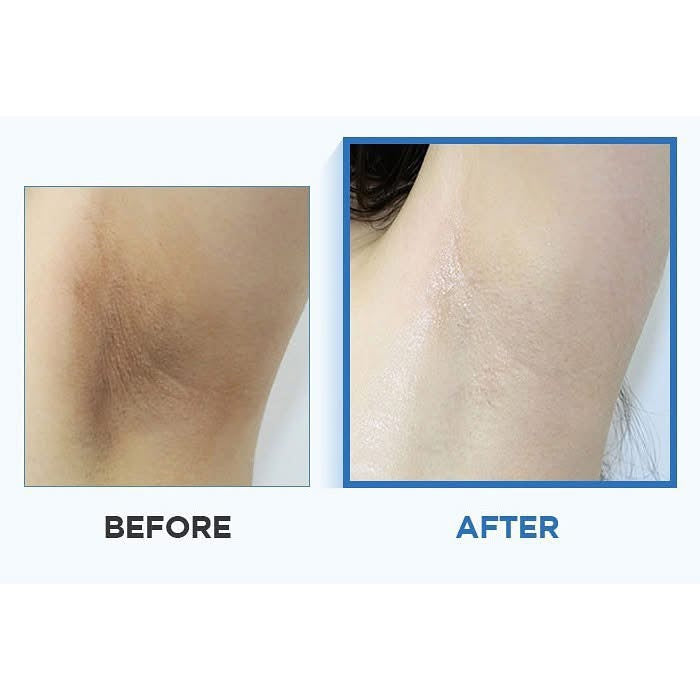 CELIMAX Ji Woo Gae One Step Body
Brightening Pad بادز لتفتيح الجسم