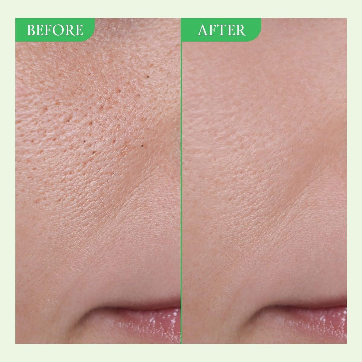 FULLY Green Tomato Serum سيروم الطماطم الخضراء